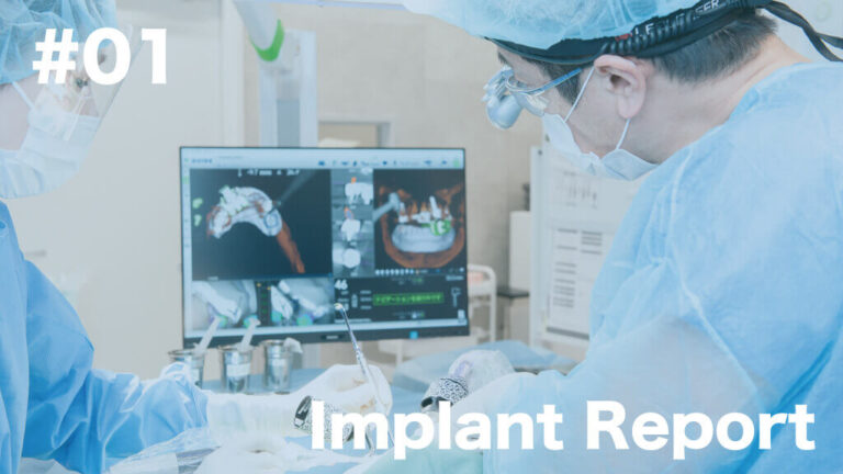 implant_case01