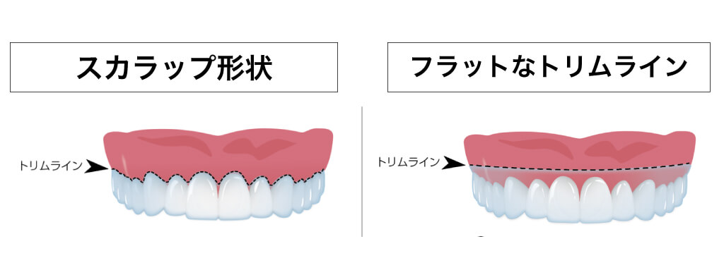 トリムライン