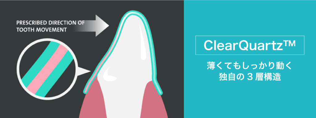 独自の3層構造