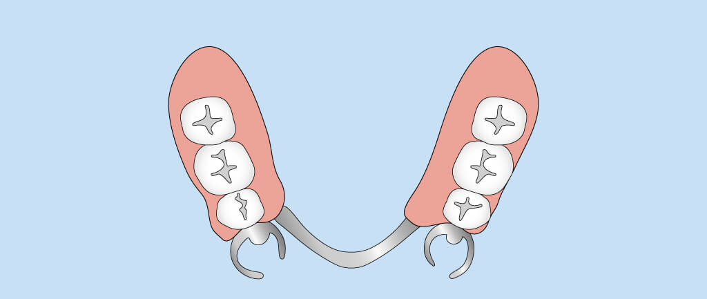 口の中を噛む原因_入れ歯が合わない