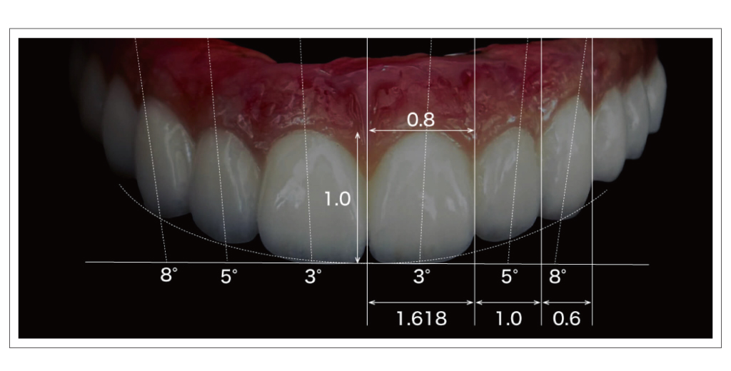 オールオン4メリット2審美性