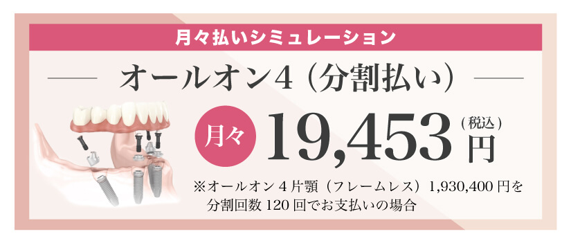 オールオン4分割払いシミュレーション2