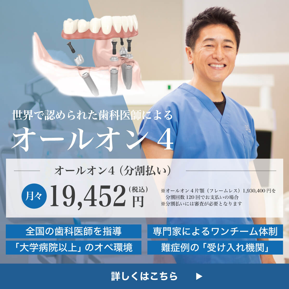 オールオン4分割払いバナー3