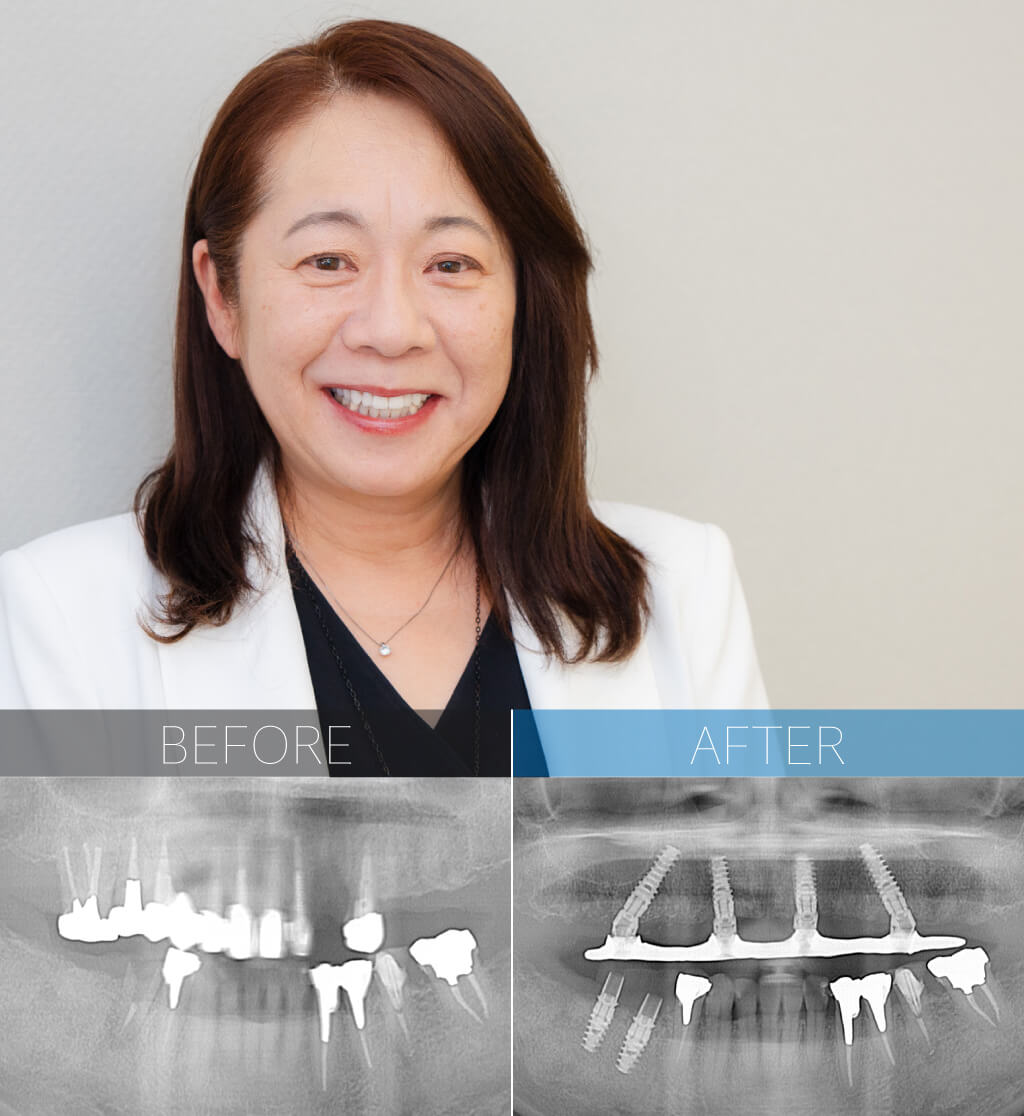 ケース7紹介画像