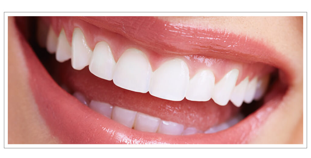 ファイナル完成のイメージ2