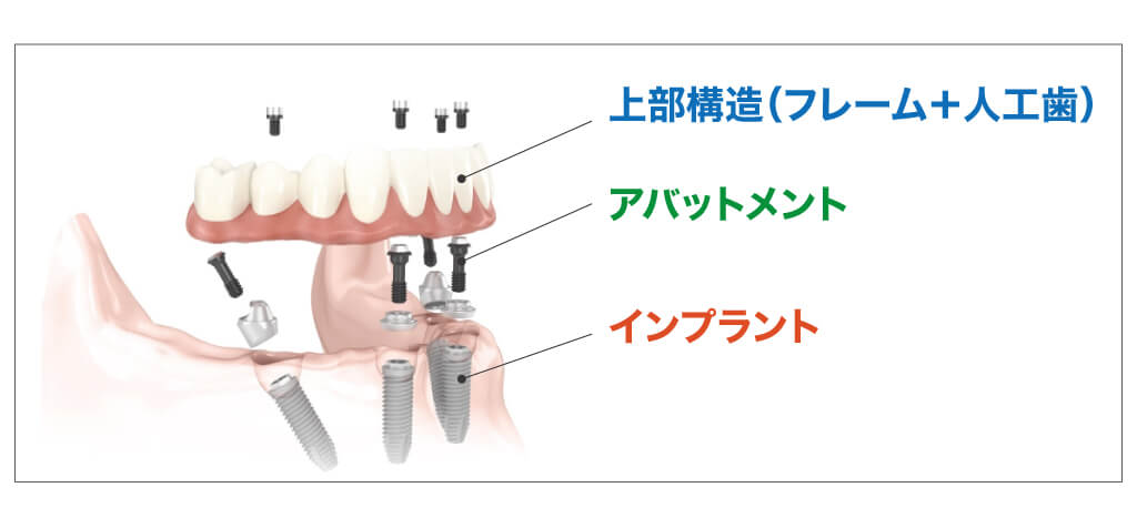 オールオン4の構造